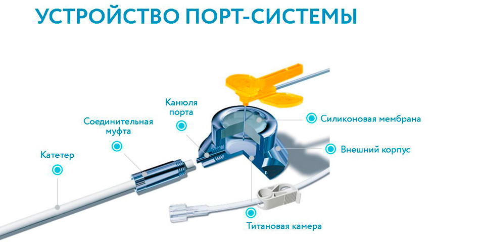 устройство порт-системы для химиотерапии